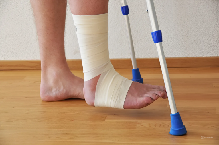 What is the Importance of Physiotherapy in Post-Fracture Healing?