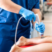 Physiotherapist performing ESWT shockwave therapy on patient knee in Vaishali